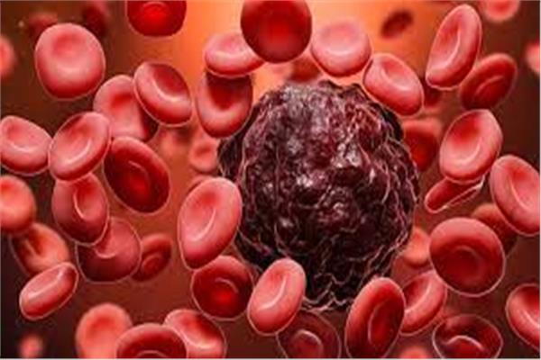 استخدام الهندسة الوراثية في علاج سرطان الدم