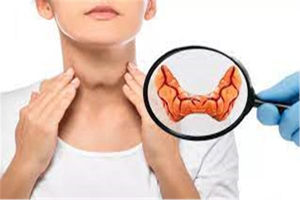 الغدة الدرقية علامات نقص اليود