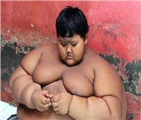 أثقل طفل في العالم يخسر 120 كيلوغراماً من وزنه