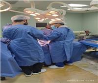 إجراء 6 عمليات جراحية بالمجان بمستشفى رشيد للقضاء على قوائم الانتظار 