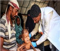 منظمة إغاثية: الوضع كارثي في اليمن والأطفال يموتون جوعاً