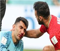 تغيير اضطراري.. إصابة دموية لحارس إيران أمام إنجلترا في كأس العالم 