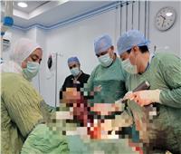 نجاح أطباء مستشفى غرب النوبارية في إجراء عمليتين جراحيتين ذات مهارة خاصة