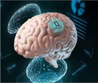 «الينك» .. شرائح إلكترونية في الدماغ للعلاج أم لأهداف أخرى ؟